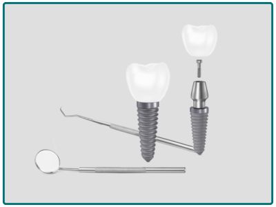 فروش و پشتیبانی ایمپلنت‌های Warantec