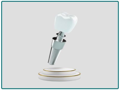 پشتیبانی پس از فروش و تأمین قطعات یدکی